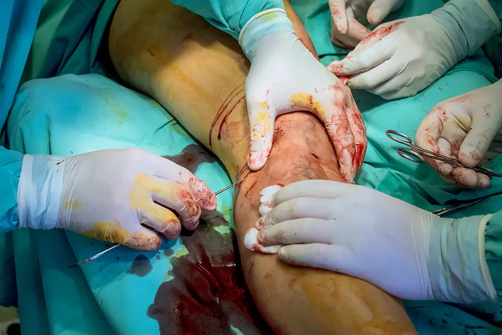Best Vascular Surgeon in Islamabad - Dr. Syed Muhammad Azeem